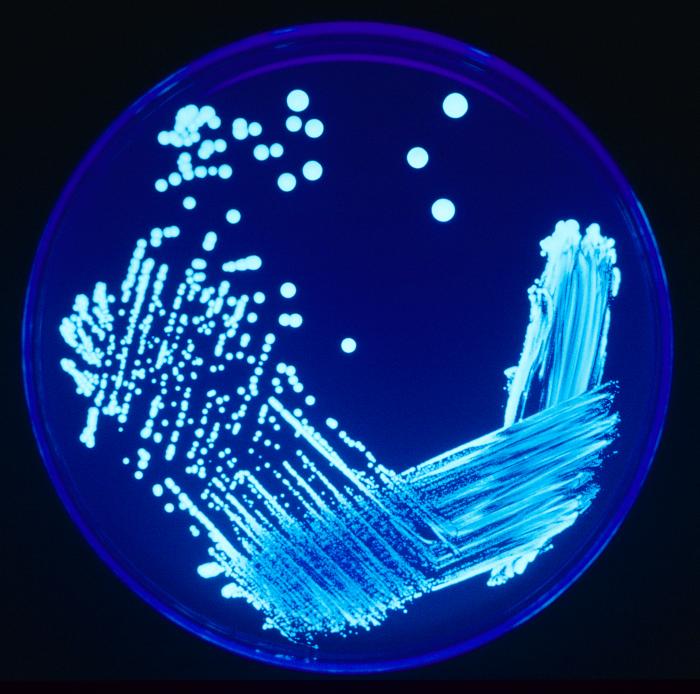 legionella